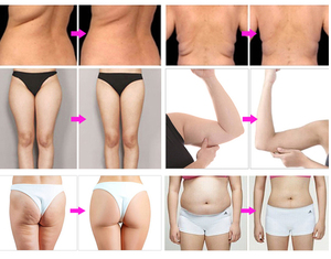 Sıcak Satış Profesyonel 3'ü 1 Arada Presoterapi Lenf Drenajı Kas Stimülatörü Presoterapi Makinesi Kilo Kaybı İçin - Product Image 5