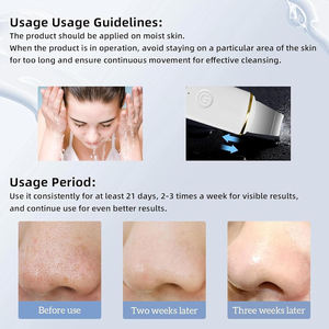 Herramienta Exfoliante Corporal 4 en 1, Espátula para Poros, Cepillo de Limpieza Facial Sónico, Limpiador Facial Eléctrico, Exfoliante Ultrasónico para la Piel - Product Image 5