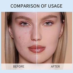 <span class=keywords><strong>Gel</strong></span> Nettoyant Exfoliant <span class=keywords><strong>Visage</strong></span> à l'Acide Aminé Hydratant et Purifiant pour Éliminer les Peaux Mortes – Meilleure Vente - Product Image 4