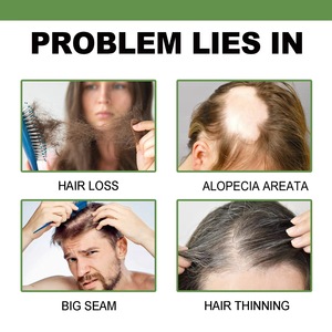 Loción en aerosol para tratamiento de nutrientes de raíz de cabello de etiqueta privada para uso diario, prevención y nutrición naturales de la pérdida de cabello - Product Image 2