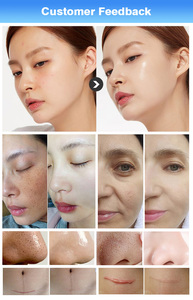 SPA906 Professional 15 in 1 Aqua Peel Facial Rejuvenation Lifting Skin Care Beauty Hydro Microdermabrasion <b>Machine</b> - Product Image 6