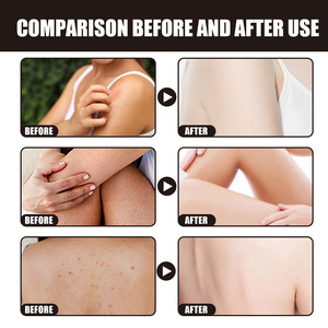 Gommage corporel à la fraise Exfoliant Hydratant Gommage corporel Gommage au sucre Hydrater la peau nettoyante en douceur 100g - Product Image 2
