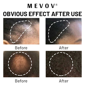OEM OBM croissance des cheveux bio huile de coco avocat perte de cheveux <span class=keywords><strong>shampooing</strong></span> et après-<span class=keywords><strong>shampooing</strong></span> à la biotine <span class=keywords><strong>shampooing</strong></span> au vinaigre de cidre de pomme - Product Image 5