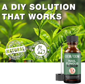 Traitement pour les ongles, accessoire de pédicure pour les pieds et les orteils, traitement pour les doigts et les orteils, Nail-art, 120 pièces - Product Image 3