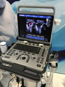 Chison Ebit50 draagbare echografiemachine Kleuren <span class=keywords><strong>Doppler</strong></span> voor OB&GYN, hartmeting met twee probes - Product Image 3