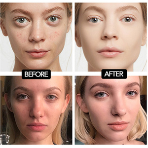 Base de Maquillaje Líquida Mate de 30 ml, No Porosa, con Hidratante para el <span class=keywords><strong>Rostro</strong></span>, Cobertura Alta, Corrector y Aislamiento de Marcas de Acné - Product Image 3