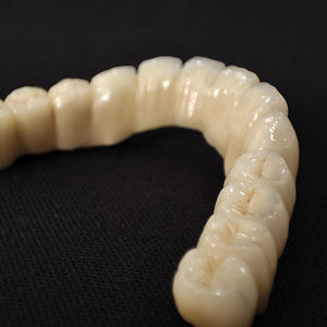Ponts et couronnes en céramique en métal PFM laboratoire dentaire chinois meilleur <span class=keywords><strong>prix</strong></span> de fabrication bon marché - Product Image 3