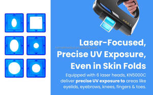 Láser Excimer de Alta Intensidad Kernel de 308nm, Máquina de Tratamiento de 308nm para Vitiligo, Psoriasis y Eccema KN-5000C - Product Image 3