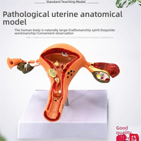 Sistema reproductivo femenino, herramienta de enseñanza de anatomía, modelo de útero humano con Vagina y ovarios, modelo de órgano de simulación patológica
