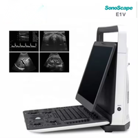 Machine à ultrasons vétérinaire Sonoscape e1v pour machine à ultrasons portable pour animaux doppler couleur vétérinaire