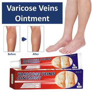 Pommade pour le soulagement des <span class=keywords><strong>varices</strong></span>, la vascularite et la phlébite, réduit l'enflure et la douleur, <span class=keywords><strong>traitement</strong></span> des <span class=keywords><strong>varices</strong></span> - Product Image 2