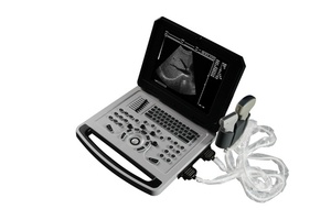 Sonda ad ultrasuoni wireless <span class=keywords><strong>3</strong></span> In 1 color doppler wifi e connessione usb MSLPU80 - Product Image 1