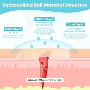 Rouleau de pansement hydrocolloïde Rouleau de matière première adhésif Jumbo Rouleau hydrocolloïde - Product Image 2