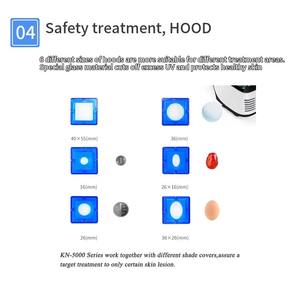 Pabrik disesuaikan penggunaan rumah ukuran kecil portabel 308nm intensitas tinggi LED fototerapi UV untuk perawatan Vitiligo - Product Image 3
