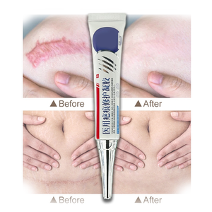 麗肌湯 天然ハーブプロフェッショナル オールナチュラル傷跡緩和クリーム、強力な治療傷跡ジェル - Product Image 1