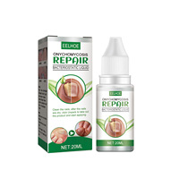 Sérum de Traitement Haute Qualité pour Mycoses des Ongles, Produits Réparateurs pour les Mycoses des Orteils, Gel de Soin Mains et Pieds, Anti-Onychomycose et Paronychie