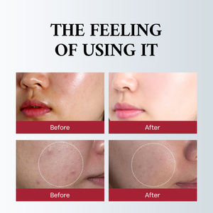 Kit de Regalo al por Mayor de Glutatión para el Cuidado de la Piel, Blanqueamiento y Luminosidad, Desvanece Manchas Oscuras, Unifica el Tono de la Piel, Productos de Belleza - Product Image 4