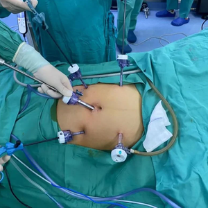 ใบมีดผ่าตัดแบบใช้แล้วทิ้งราคาโรงงาน สำหรับการผ่าตัดผ่านกล้อง พร้อมปลอก ขนาด 5 <span class=keywords><strong>10</strong></span> 12 15 มม. - Product Image 6