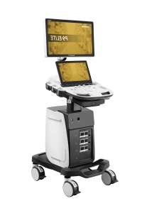 Sonoscape P9Elite 4D 5D Échographie Doppler Couleur Portable Gynécologie Obstétrique Cardiovasculaire Ecografo Doppler Echo Machine - Product Image 3