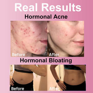 Winstown Gommes saines à base de plantes naturelles <span class=keywords><strong>PMS</strong></span> SOULAGEMENT Équilibre hormonal Supplément de bonbons Pudding - Product Image 6