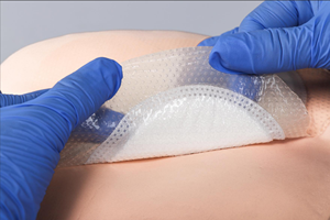 FORYOU LUOFUCON pansement super absorbant avec bordure utilisé dans l'ulcère du <span class=keywords><strong>pied</strong></span> diabétique chronique ulcère de jambe pression prévention des ulcères - Product Image 3