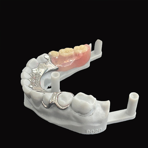 Cadre en alliage Cocr pour prothèses partielles avec base en résine dents acryliques prothèses amovibles en laboratoire dentaire en chine - Product Image 4