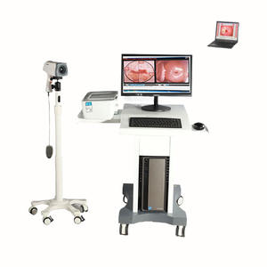 गिरी KN-2200 0.8MP स्त्री रोग स्त्री रोग वीडियो Colposcope कैमरा पूर्ण HD 1080p इलेक्ट्रॉनिक colposcope - Product Image 1