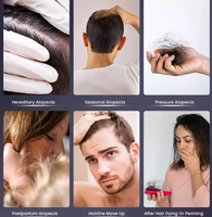 Marque Blanche Huile 100% Naturelle Biologique de Romarin, Ricin et Amande pour Hommes et Femmes, Sérum de Soin du Cuir Chevelu, Huile de Traitement pour la Croissance Capillaire