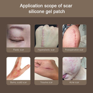 Neues Produkt Effektives Narbenentfernungs-Gel Reparatur-Patch Silikon-Narbenpflaster Koreanisch - Product Image 2