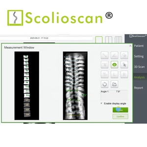 Scolioscan siêu âm VẸO CỘT SỐNG đánh giá trạm làm việc SCN 201 thăm dò ai thuật toán <span class=keywords><strong>3D</strong></span> tái thiết phần mềm sử dụng miễn phí - Product Image 2