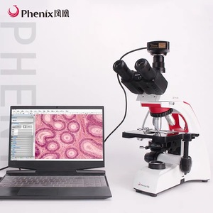 Máy Ảnh Kính Hiển Vi Phenix <span class=keywords><strong>C</strong></span> <span class=keywords><strong>Mount</strong></span> 5MP USB2.0 Dành Cho Kính Hiển Vi Sinh Họ<span class=keywords><strong>c</strong></span> Trinocular - Product Image 3