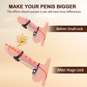 Penis Extender Verstelbare Stretchkit Met Siliconen Beschermer, Langere Erectietijd Draagbaar Penis Trainingsapparaat - Product Image 2