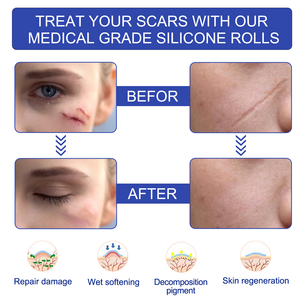 ELAIMEI 3m Silicone rimozione cicatriziale rotolo di smagliature trasparente Silicone impermeabile foglio cicatriziale per tutti i tipi di pelle - Product Image 6