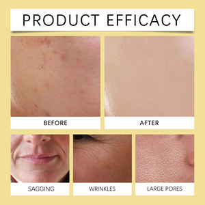 Mascarilla hidratante profunda con niacinamida, ilumina, desvanece manchas oscuras, uniforma el tono de la piel, retiene la humedad para piel seca, uso diario, 4 unidades - Product Image 4