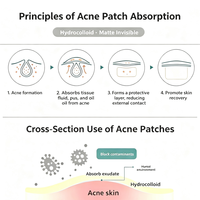 Patchs Hydrocolloïdes Scintillants pour l'Acné, 8 Couleurs en Forme d'Étoile, Dissimulent les Imperfections, Décoration de Fête, Fabrication ODM OEM