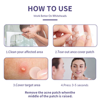 Patchs Hydrocolloïdes Ronds Mignons pour Boutons, Autocollants Décoratifs Amusants et Imperméables pour le Traitement des Imperfections du Visage