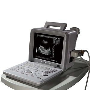 Thiết bị y tế LED xách tay máy siêu âm máy đầy đủ kỹ thuật số siêu âm hệ thống chẩn đoán - Product Image 2