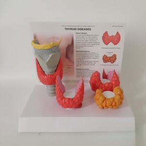 Tıbbi % Model beyin insan tiroid hastalığı anatomi modeli, endokrinoloji eğitimi için gerçekçi tiroid patoloji simülatörü - Product Image 2