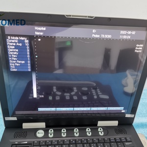 Système d'échographie numérique complet pour ordinateur portable, appareil d'échographie noir et blanc pour usage humain ou vétérinaire BW22 - Product Image 4