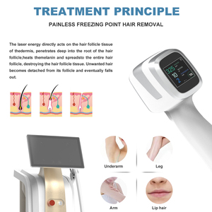 Dispositivo Portatile Non Cristallino per Epilazione Laser a Diodi a 3 Lunghezze d'Onda con Funzione Sbiancante per Tutti i Tipi di Pelle - Product Image 4