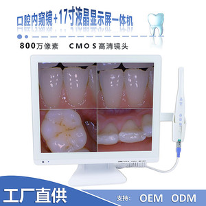 Sistema de Endoscopia Dental con Monitor de 17 Pulgadas, 800W Píxeles, Equipo Médico de Observación Oral - Product Image 5