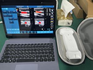 Full Digital Medical Sonda Sem Fio Ultrassom Scanner 3 em 1 Cor Sonda Portátil Doppler Portátil - Product Image 4