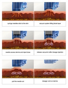 Máy Tính Để Bàn Tự Động Mesotherapy Súng Cho Khuôn Mặt Cơ Thể Trẻ Hóa Da Âm Đạo Thắt Chặt Nếp Nhăn Tiêm Chuyên Nghiệp Salon Spa - Product Image 5