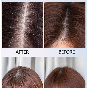 Shampooing Herbal Doux et Non Irritant aux Feuilles de Platycodon Grandiflorus Purifie en Profondeur le <span class=keywords><strong>Cuir</strong></span> <span class=keywords><strong>Chevelu</strong></span> Sensible - Product Image 5