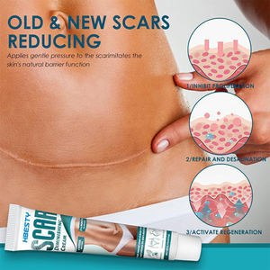 Caliente acné quirúrgico estrías eliminación cicatriz crema espinillas cara Gel niño acné alisado blanqueamiento cuerpo cuidado de la piel pigmentación - Product Image 3