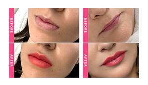 <span class=keywords><strong>Injection</strong></span> de comblement des lèvres professionnel Hadurage 2x1ml - Comblement dermique rouge pour des lèvres pulpeuses et une hydratation profonde - Product Image 6