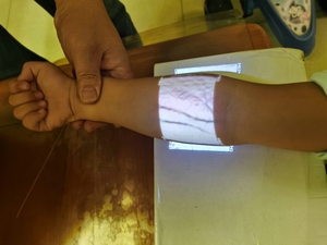 Pencari Vena Inframerah Portabel Resolusi Tinggi Berbagai Ukuran Pencitraan Terang untuk Klinik Rumah Sakit Hewan dengan Penyangga - Product Image 3