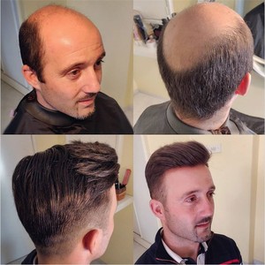 Prótesis Capilar para <span class=keywords><strong>Hombre</strong></span> de Cabello Humano Brasileño Remy 100% con Base de PU Ultrafina, Estilo Mono Fino y Duradero, con Cabello Rizado - Product Image 6