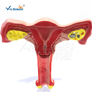 Modèle anatomique ovarien et utérin féminin Vic Education, modèle pédagogique de la reproduction humaine - Product Image 2
