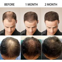 Huile Capillaire 100% Naturelle pour la Croissance des Cheveux, Soin des Racines, Renforcement Capillaire, Huile de Ricin, Huile de Jojoba, Huile de Romarin, Marque Privée